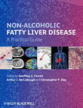 Farrell / McCullough / Day | Non-Alcoholic Fatty Liver Disease | E-Book | sack.de