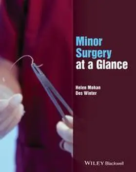 Mohan / Winter |  Minor Surgery at a Glance | eBook | Sack Fachmedien