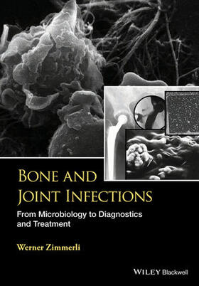 Zimmerli | Bone and Joint Infections: From Microbiology to Diagnostics and Treatment | Buch | 978-1-118-58177-3 | sack.de
