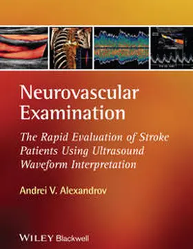 Alexandrov | Neurovascular Examination | E-Book | www.sack.de