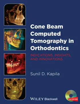 Kapila | Cone Beam Computed Tomography in Orthodontics | E-Book | www.sack.de