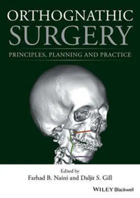 Naini / Gill | Orthognathic Surgery | E-Book | www.sack.de