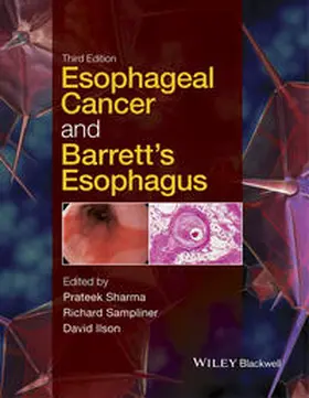 Sharma / Sampliner / Ilson | Esophageal Cancer and Barrett's Esophagus | E-Book | www.sack.de