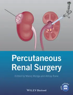 Monga / Rane |  Percutaneous Renal Surgery | eBook | Sack Fachmedien