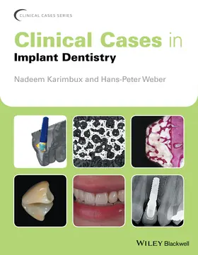 Karimbux / Weber | Clinical Cases in Implant Dentistry | Buch | 978-1-118-70214-7 | www.sack.de