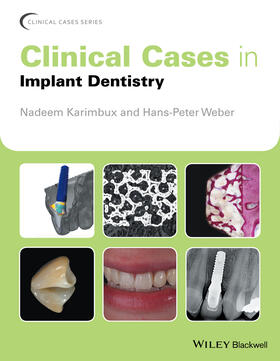 Karimbux / Weber | Clinical Cases in Implant Dentistry | Buch | 978-1-118-70214-7 | sack.de