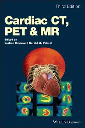 Dilsizian / Pohost |  Cardiac CT, PET and MR | eBook | Sack Fachmedien