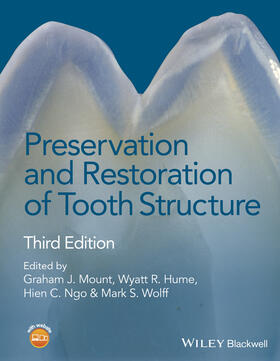 Mount / Hume / Ngo | Preservation and Restoration of Tooth Structure | Buch | 978-1-118-76659-0 | sack.de