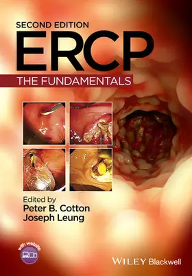 Cotton / Leung |  Ercp: The Fundamentals | Buch |  Sack Fachmedien