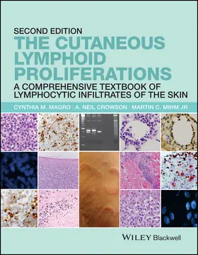 Magro / Crowson / Mihm |  The Cutaneous Lymphoid Proliferations | Buch |  Sack Fachmedien