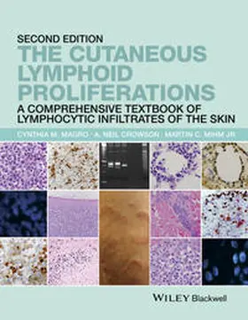 Magro / Crowson / Mihm |  The Cutaneous Lymphoid Proliferations | eBook | Sack Fachmedien