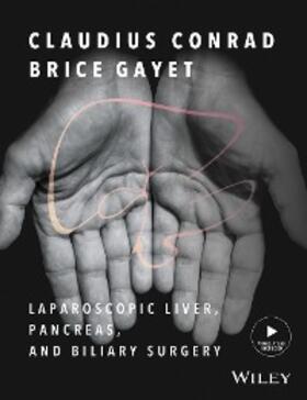 Conrad / Gayet | Laparoscopic Liver, Pancreas, and Biliary Surgery | E-Book | sack.de
