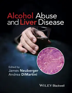DiMartini / Neuberger |  Alcohol Abuse and Liver Disease | Buch |  Sack Fachmedien