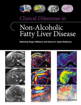 Williams / Taylor-Robinson |  Clinical Dilemmas in Non-Alcoholic Fatty Liver Disease | Buch |  Sack Fachmedien