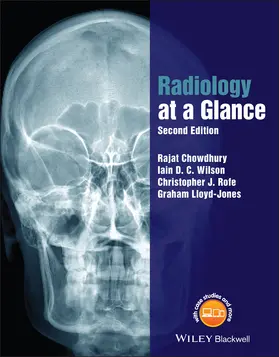 Chowdhury / Wilson / Rofe | Radiology at a Glance | Buch | 978-1-118-91477-9 | www.sack.de