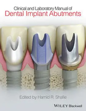 Shafie | Clinical and Laboratory Manual of Dental Implant Abutments | E-Book | www.sack.de
