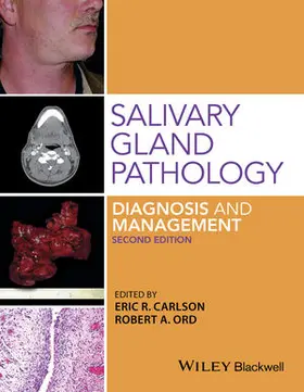 Carlson / Ord |  Salivary Gland Pathology | Buch |  Sack Fachmedien