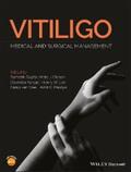 Gupta / Olsson / Parsad |  Vitiligo | eBook | Sack Fachmedien