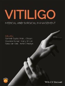 Gupta / Olsson / Parsad | Vitiligo | E-Book | sack.de
