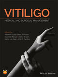 Gupta / Olsson / Parsad |  Vitiligo | Buch |  Sack Fachmedien