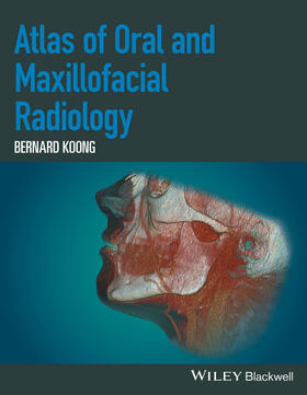 Koong | Atlas of Oral and Maxillofacial Radiology | Buch | 978-1-118-93964-2 | sack.de