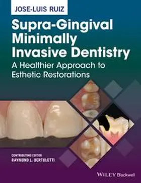 Ruiz | Supra-Gingival Minimally Invasive Dentistry | E-Book | www.sack.de