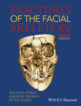 Perry / Brown / Banks |  Fractures of the Facial Skeleton | eBook | Sack Fachmedien