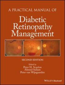 Scanlon / Sallam / van Wijngaarden | A Practical Manual of Diabetic Retinopathy Management | E-Book | sack.de