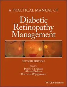 Scanlon / Sallam / van Wijngaarden |  A Practical Manual of Diabetic Retinopathy Management | eBook | Sack Fachmedien