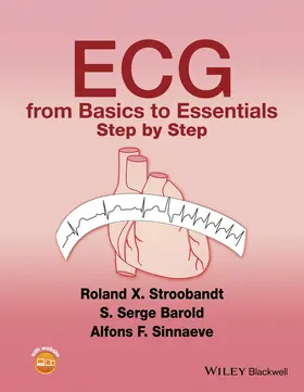 Stroobandt / Barold / Sinnaeve |  ECG from Basics to Essentials | Buch |  Sack Fachmedien