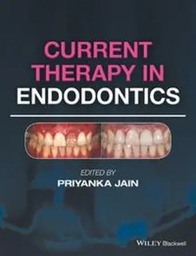 Jain |  Current Therapy in Endodontics | eBook | Sack Fachmedien