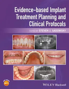 Sadowsky |  Evidence-based Implant Treatment Planning and Clinical Protocols | eBook | Sack Fachmedien