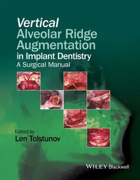Tolstunov | Vertical Alveolar Ridge Augmentation in Implant Dentistry | Buch | 978-1-119-08259-0 | www.sack.de