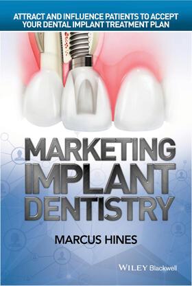Hines |  Marketing Implant Dentistry | Buch |  Sack Fachmedien