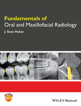 Hubar | Fundamentals of Oral and Maxillofacial Radiology | Buch | 978-1-119-12221-0 | sack.de