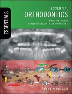 Thilander / Bjerklin / Bondemark |  Essential Orthodontics | eBook | Sack Fachmedien