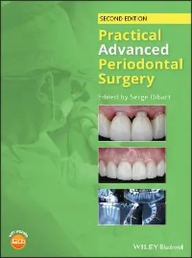 Dibart | Practical Advanced Periodontal Surgery | E-Book | www.sack.de