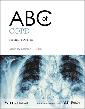 Currie | ABC of Copd | Buch | 978-1-119-21285-0 | sack.de