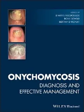 Rigopoulos / Elewski / Richert |  Onychomycosis | eBook | Sack Fachmedien