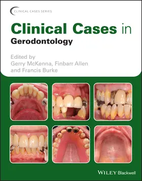 McKenna / Allen / Burke |  Clinical Cases in Gerodontology | Buch |  Sack Fachmedien