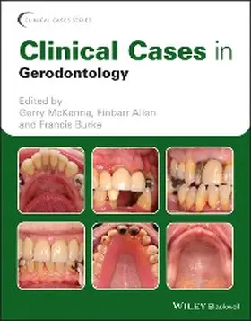 McKenna / Allen / Burke |  Clinical Cases in Gerodontology | eBook | Sack Fachmedien