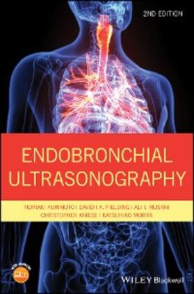 Kurimoto / Fielding / Musani |  Endobronchial Ultrasonography | eBook | Sack Fachmedien