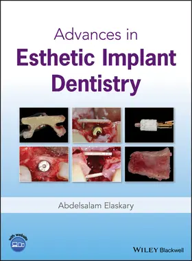 Elaskary |  Advances in Esthetic Implant Dentistry | Buch |  Sack Fachmedien