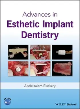 Elaskary |  Advances in Esthetic Implant Dentistry | eBook | Sack Fachmedien