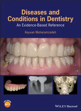 Moharamzadeh |  Diseases and Conditions in Dentistry | Buch |  Sack Fachmedien
