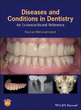 Moharamzadeh |  Diseases and Conditions in Dentistry | eBook | Sack Fachmedien