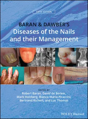 Baran / de Berker / Holzberg |  Baran and Dawber's Diseases of the Nails and Their Management | Buch |  Sack Fachmedien