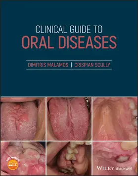 Malamos / Scully |  Clinical Guide to Oral Diseases | Buch |  Sack Fachmedien
