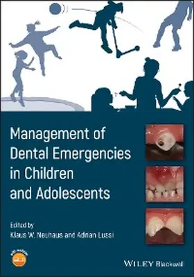 Neuhaus / Lussi |  Management of Dental Emergencies in Children and Adolescents | eBook | Sack Fachmedien