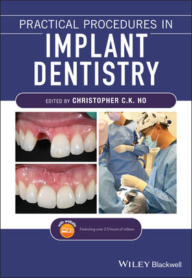 Ho | Practical Procedures in Implant Dentistry | Buch | 978-1-119-39917-9 | sack.de
